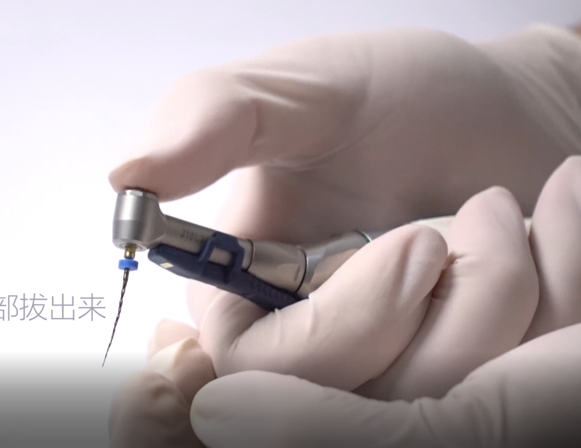 根管治疗仪iM1视频